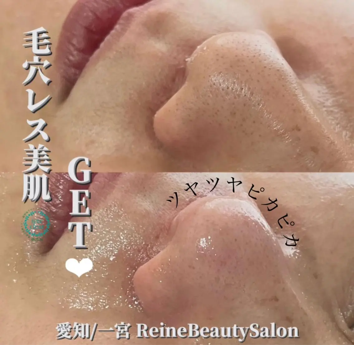 毛穴/シミ肝斑/脱毛 横山梨里のエステ・リラクイメージ