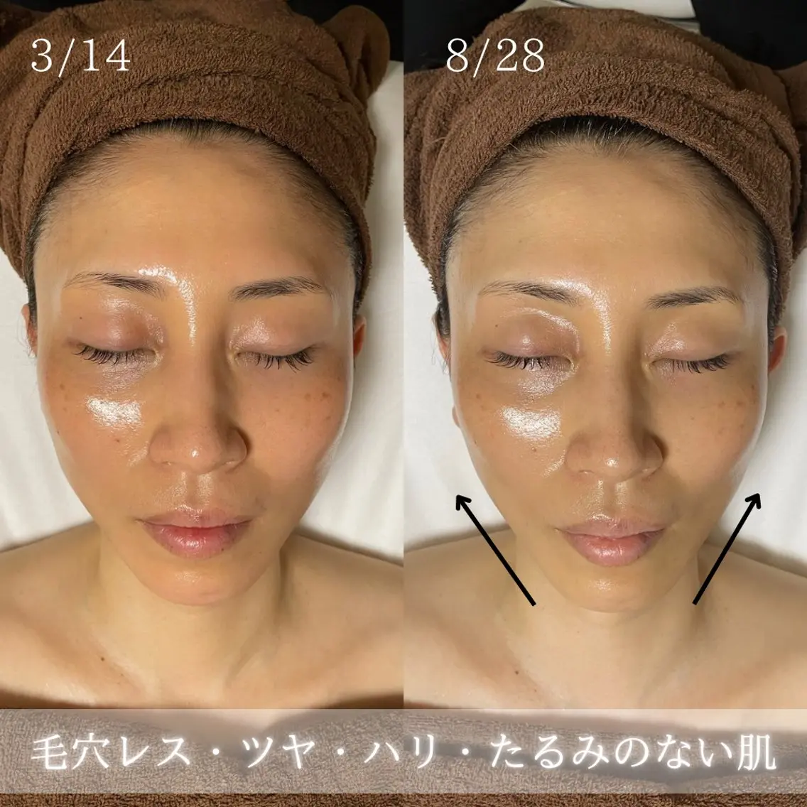 【艶肌美肌！】ミコステラでお肌のトラブル改善の写真