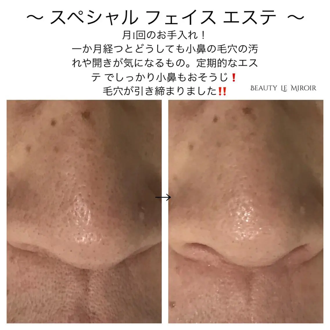 マツエク・マツパ ビューティー ミロワールのエステ・リラクイメージ