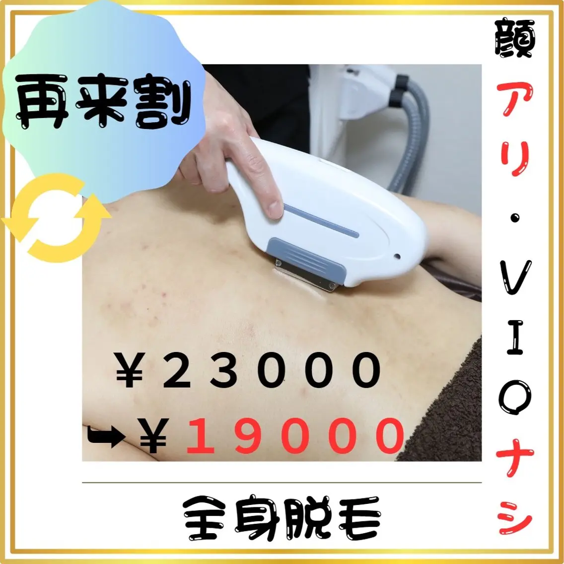 🔄再来割🔄【全身脱毛（顔有・VIO無）】 (#メンズ脱毛 　#第一印象UP  #都度払い)の写真