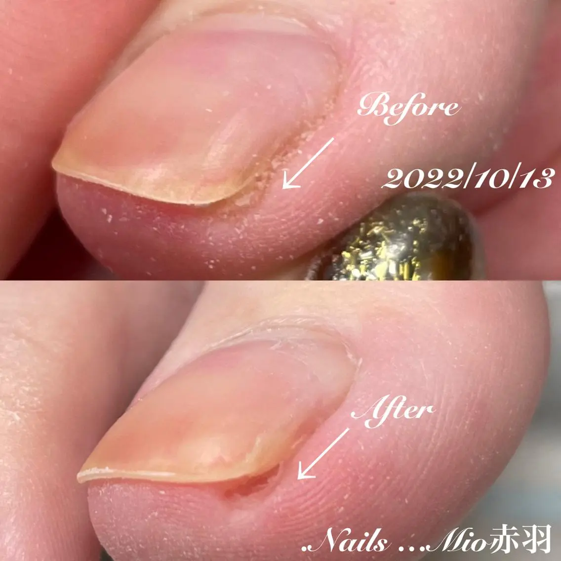 ネイル フットネイル フットネイル .Nails Mio 赤羽西ネイルサロンのネイルデザイン