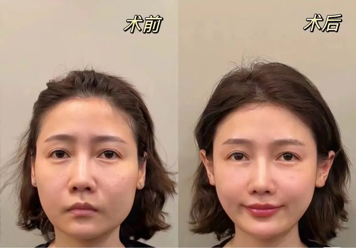 ネイル aliaハーブ水光店 エステティシャン募集のエステ・リラクイメージ