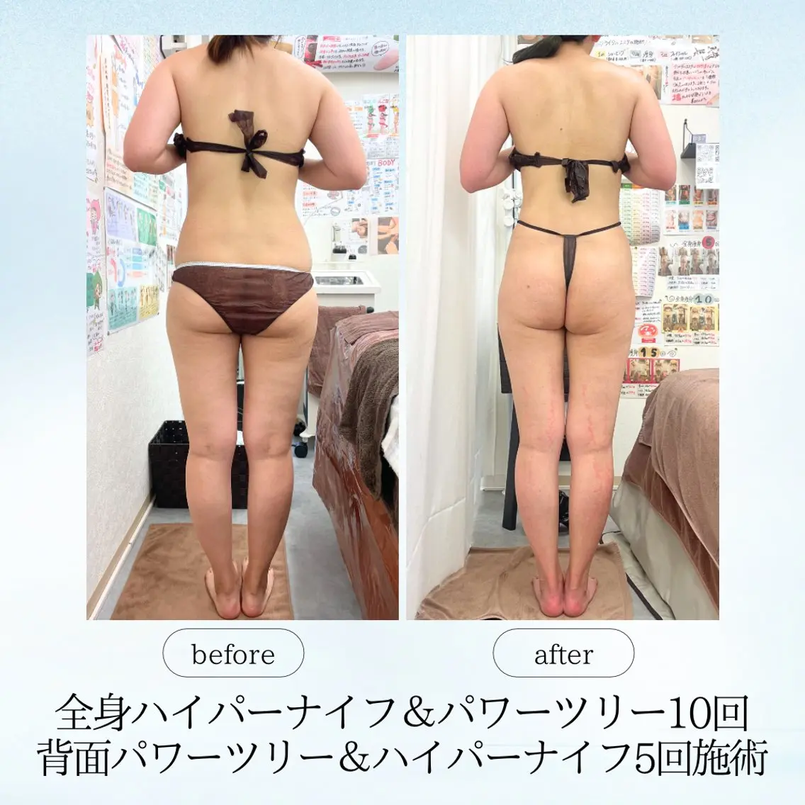 エステ リラク 《痩身、小顔専門店》 エスプレッソのエステ・リラクイメージ