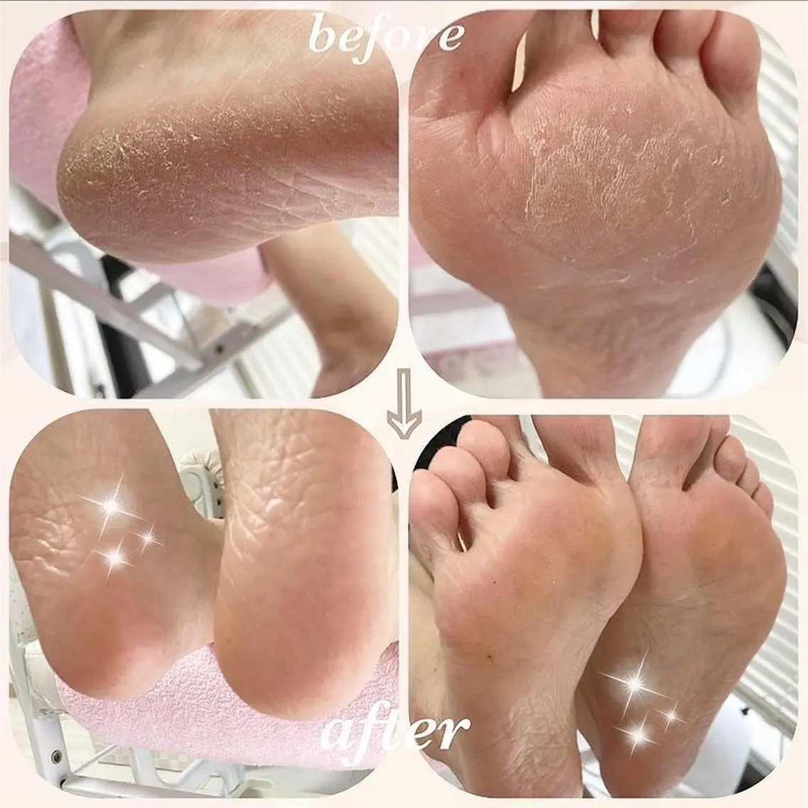 足裏ツルツルケア👣✨かかとのガサガサ撃退‼︎✨特別価格✨角質除去、スクラブ、パックと贅沢なケア💛の写真