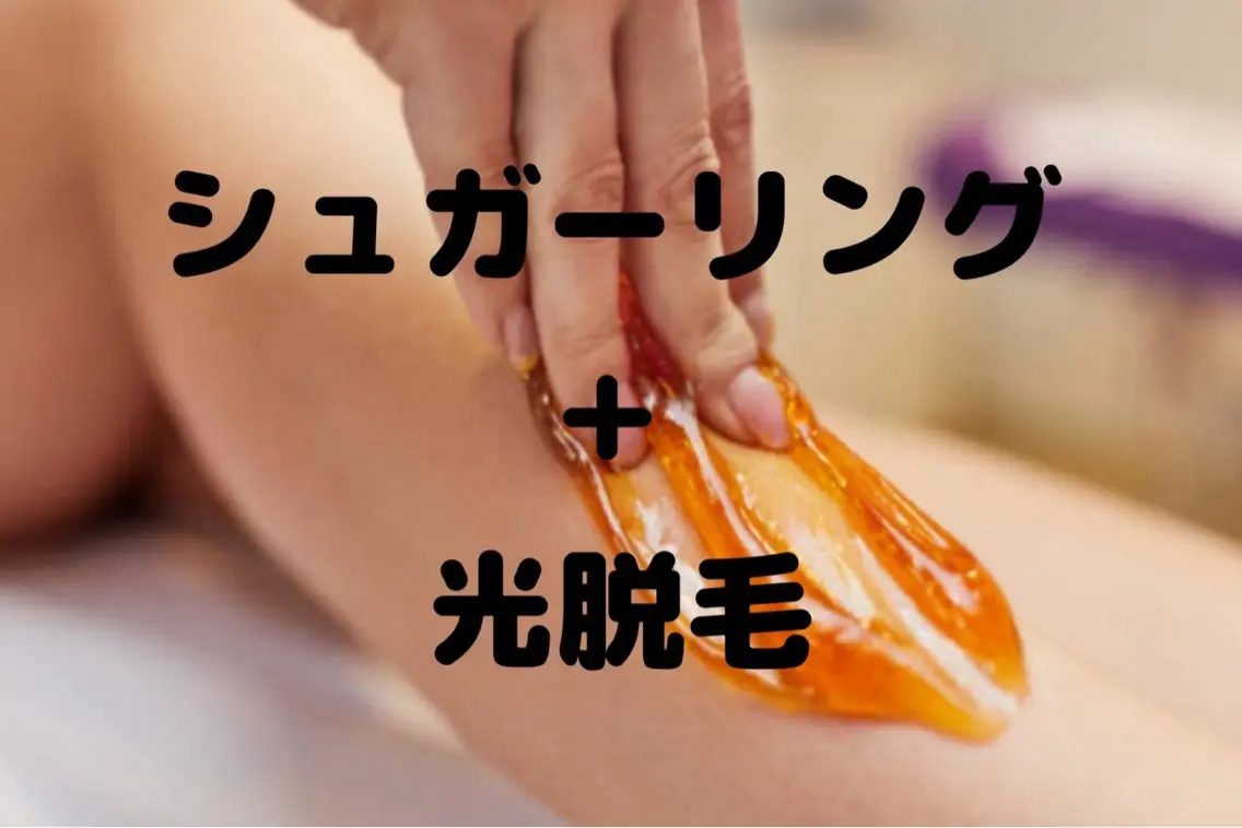 VIOシュガーリング ダブル脱毛の写真