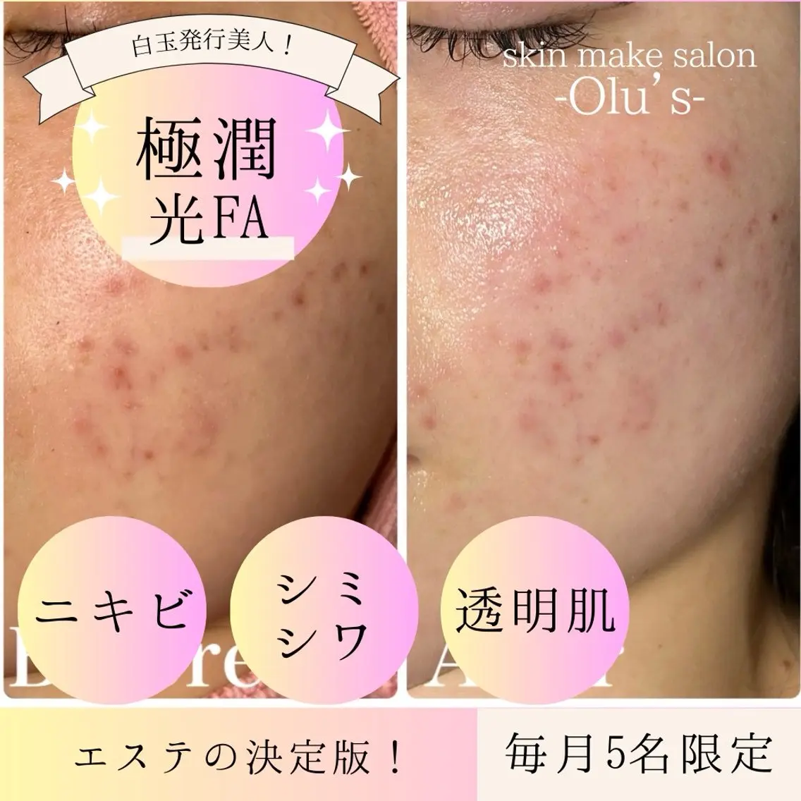 毛穴・肌質改善サロン ✨Tomaのエステ・リラクイメージ
