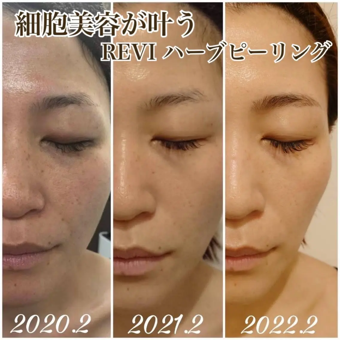 エステ 小顔リフトアップ 美肌改善専門店のエステ・リラクイメージ