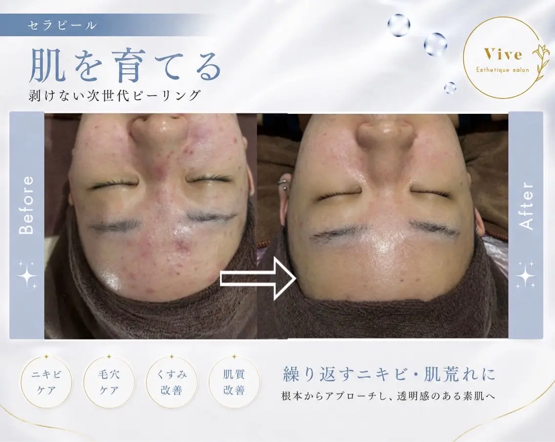 エステティックサロン Viveのエステ・リラクイメージ