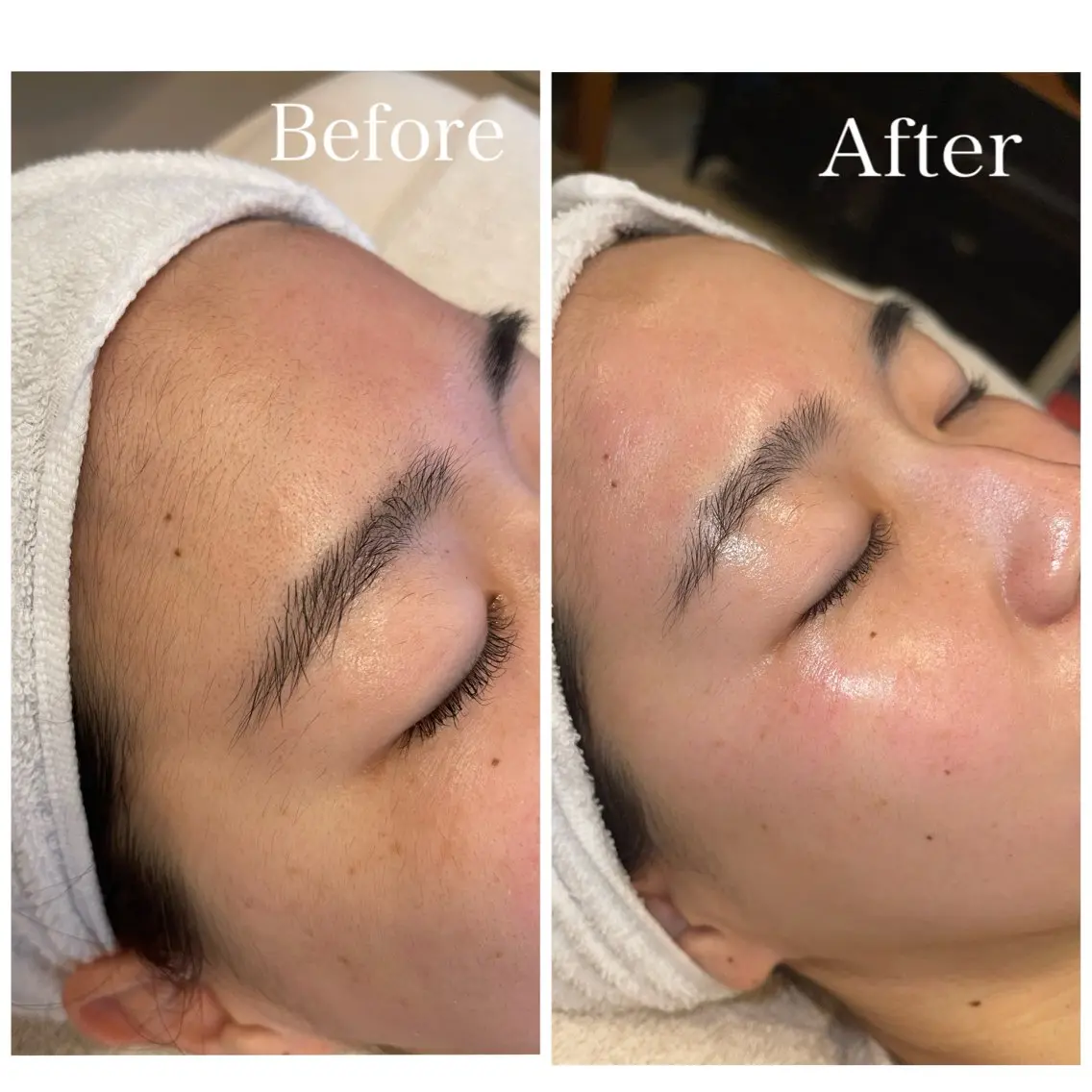 脱毛 en.  eye& facewaxのエステ・リラクイメージ