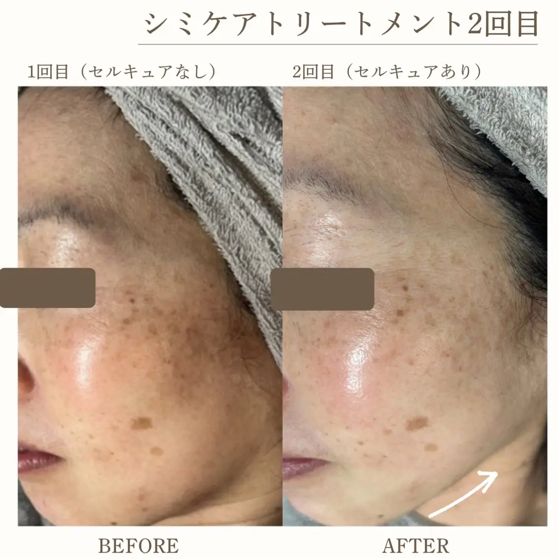 エステ シミケア・肌育サロン Jullyのエステ・リラクイメージ