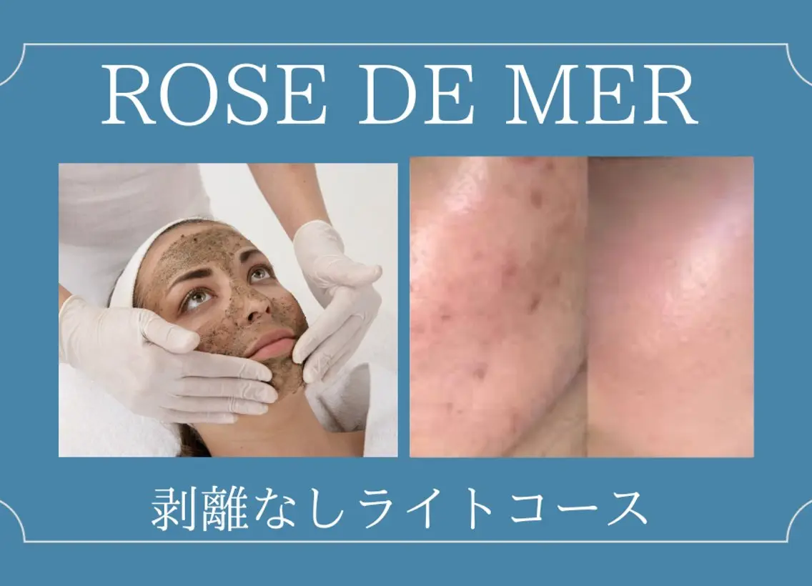【剥離なしハーブピーリング】クリスティーナ◇ライトローズドメーラ⚓️繰り返す肌荒れ/ニキビ跡/ごわつき/毛穴に◎の写真