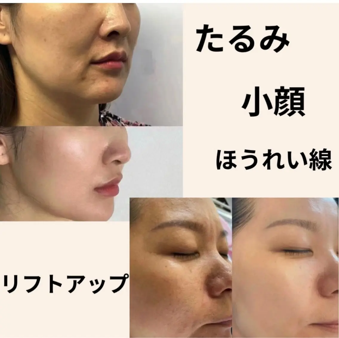 マツエク・マツパ エステ リラク 愛維美水光美肌専門店 メンズレディースokのエステ・リラクイメージ