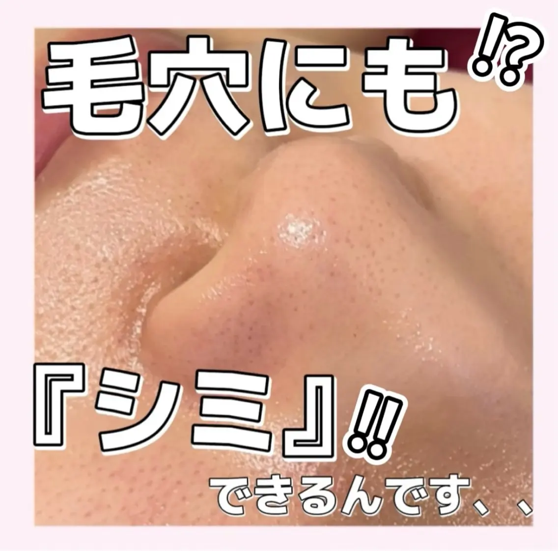 毛穴/シミ肝斑/脱毛 横山梨里のエステ・リラクイメージ