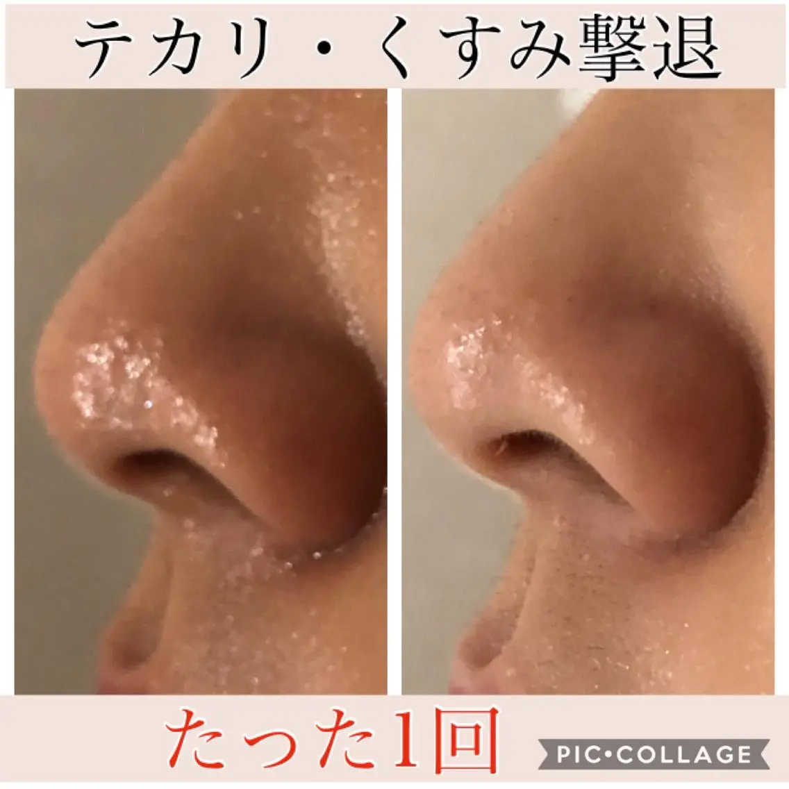 ミディアム カラー パーマ ヘアアレンジ キッズ ネイル マツエク・マツパ エステ リラク EnsorClair 代表　野口真央のエステ・リラクイメージ