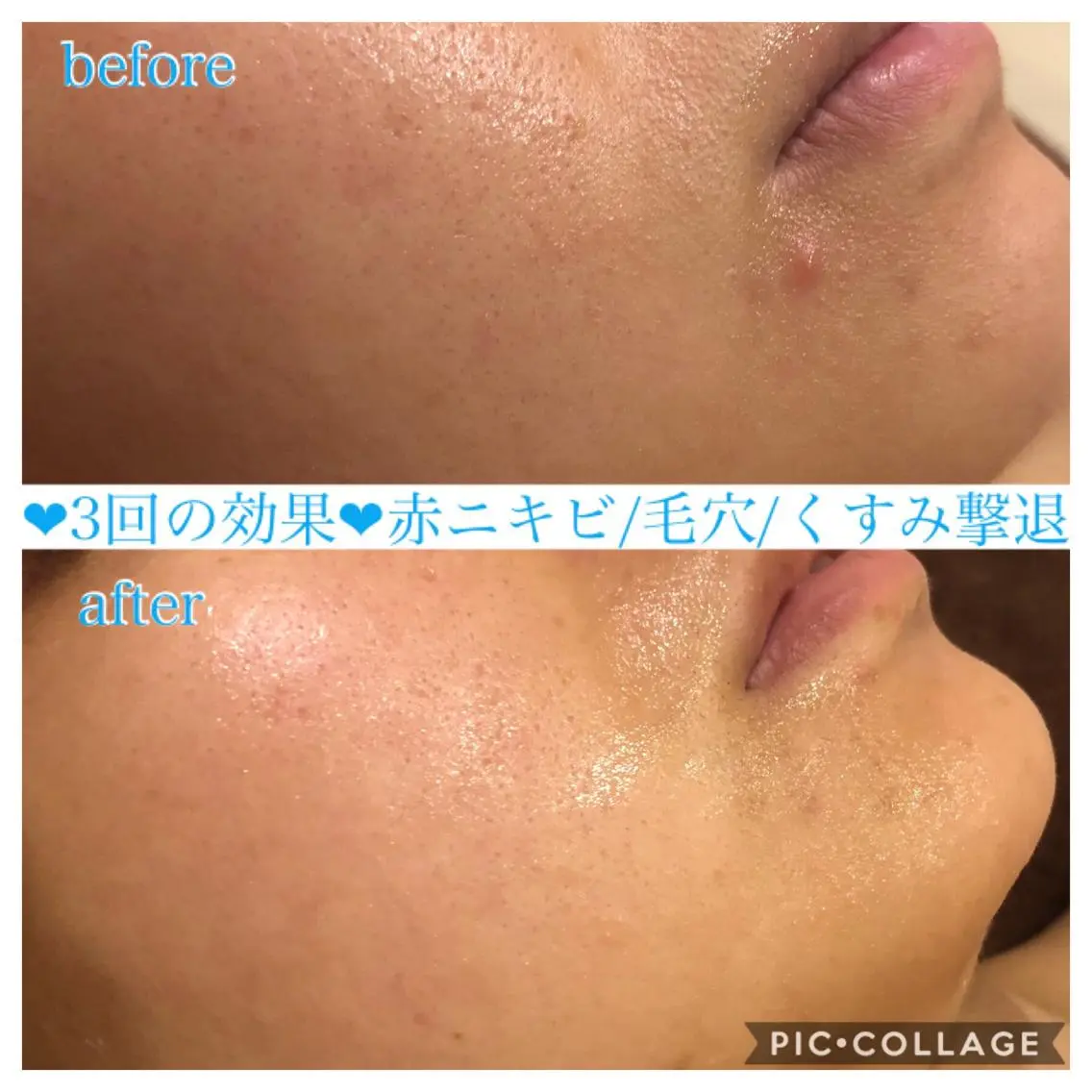 ミディアム カラー パーマ ヘアアレンジ キッズ ネイル マツエク・マツパ エステ リラク EnsorClair 代表 野口真央のエステ・リラクイメージ