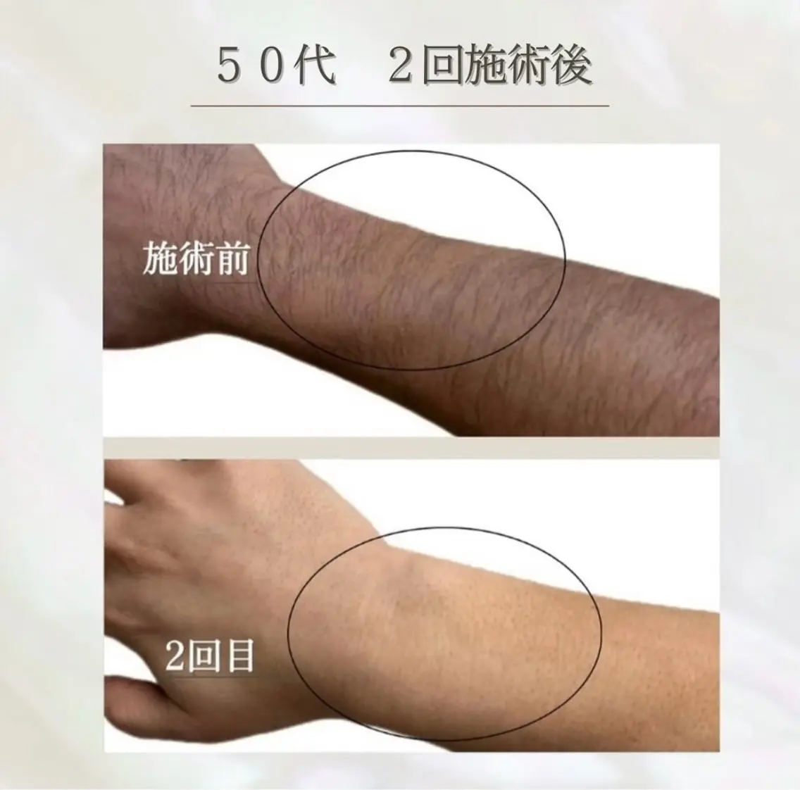 LED脱毛サロン 💐ayaのエステ・リラクイメージ