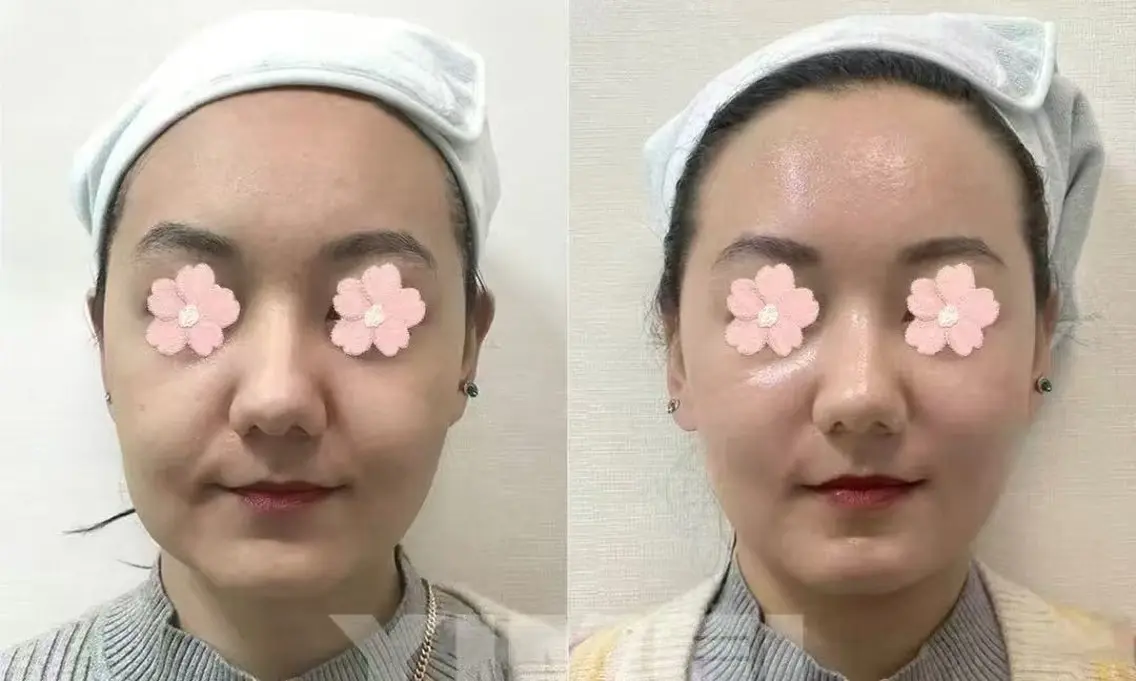 ショート 愛維美水光専門店 川崎彩鳳のエステ・リラクイメージ