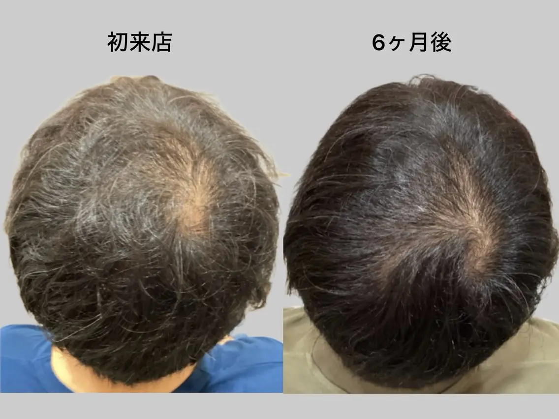 【モニター募集】498000円→297000円✨月額33000円×9ヶ月限定プロジェクト!インタビュー協力で3万円!の写真