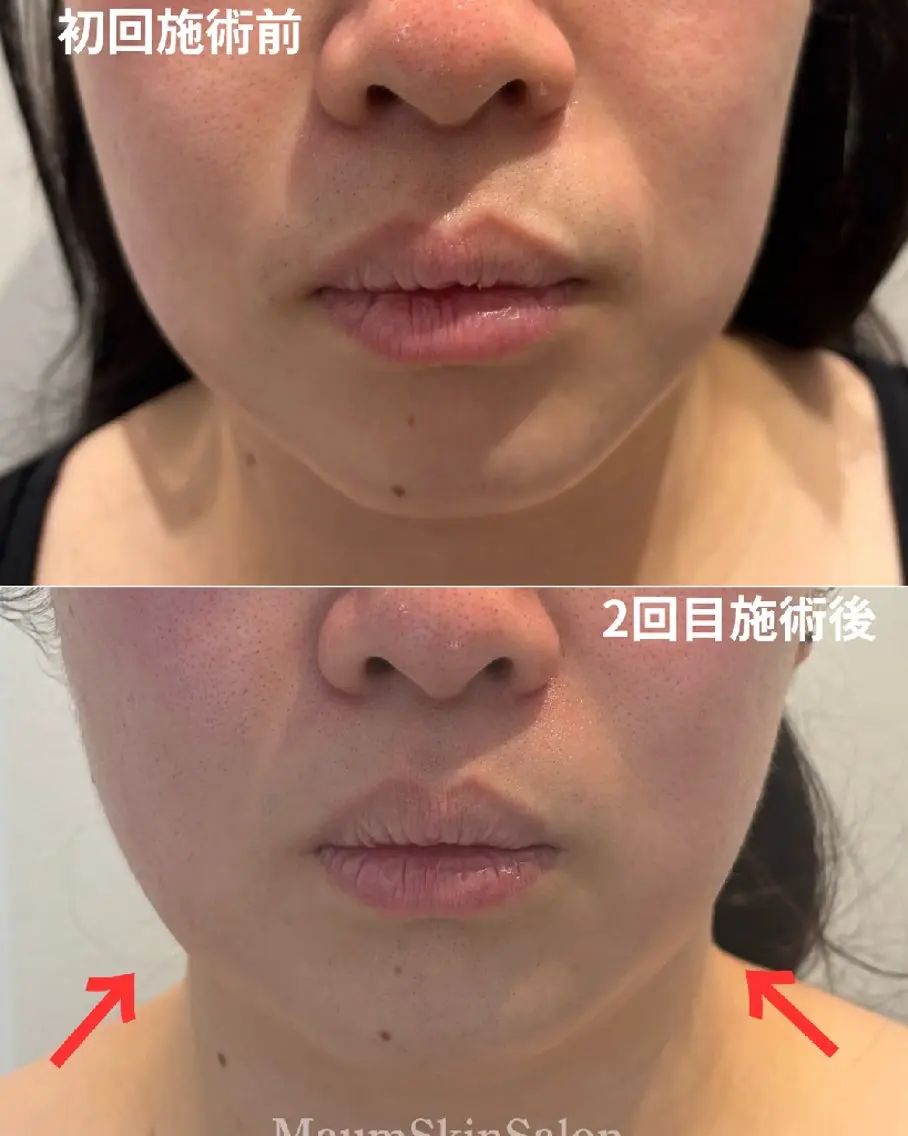 エステ Maum SkinSalonのエステ・リラクイメージ
