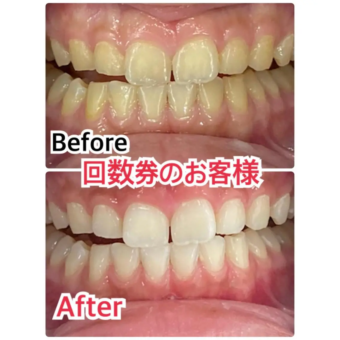 アイブロウ 【歯科提携】柏ホワイ トニングスタイルのその他イメージ