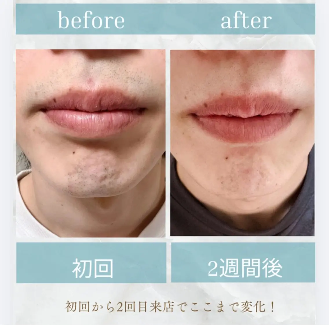 脱毛サロン moco selfのエステ・リラクイメージ