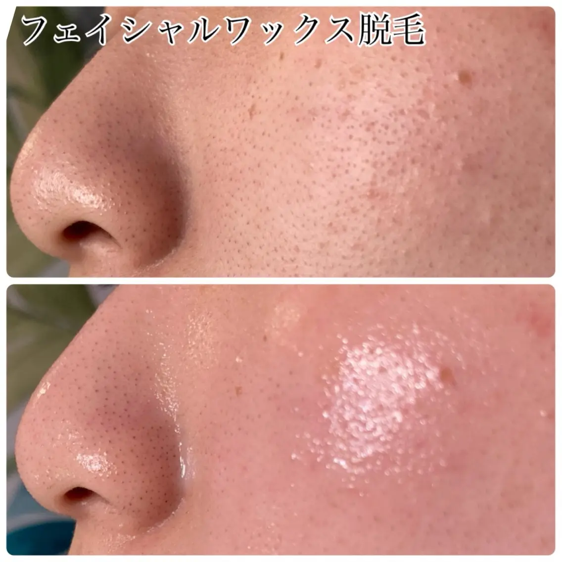 肌改善・脱毛・痩身 LuanaLifeのエステ・リラクイメージ