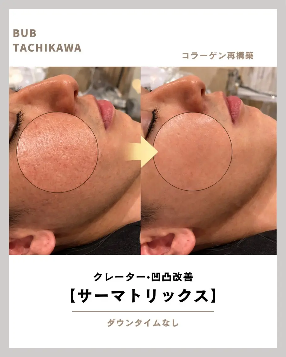 メンズ 【BUB立川】 ゆかのエステ・リラクイメージ