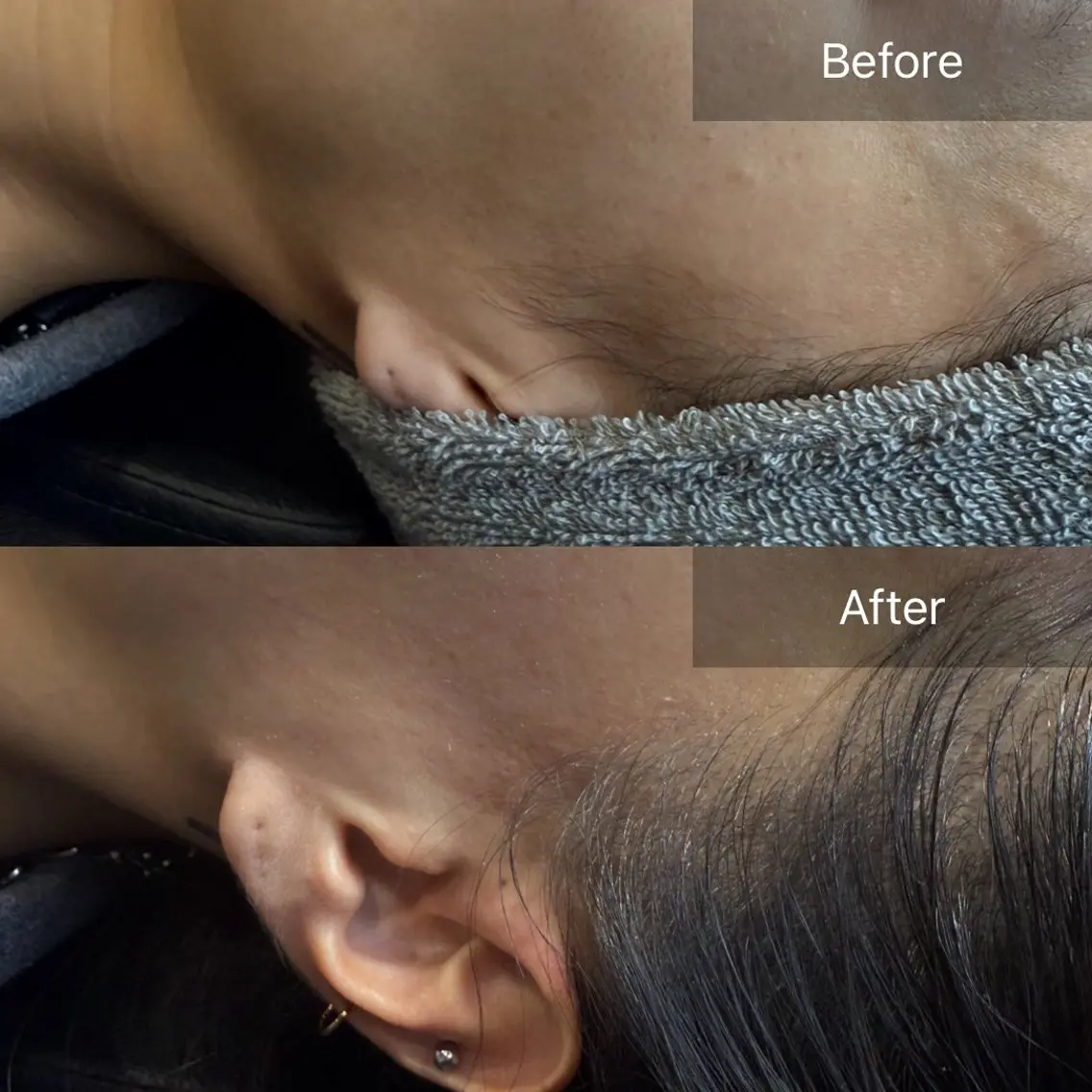 脱毛 enine フェイスWAXのエステ・リラクイメージ