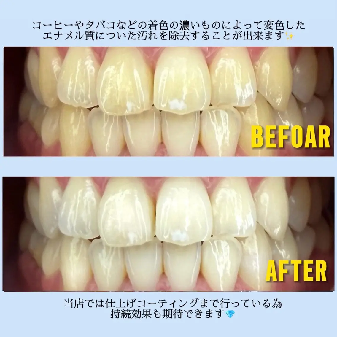 その他 ホワイトニングサロン MAYUのその他イメージ