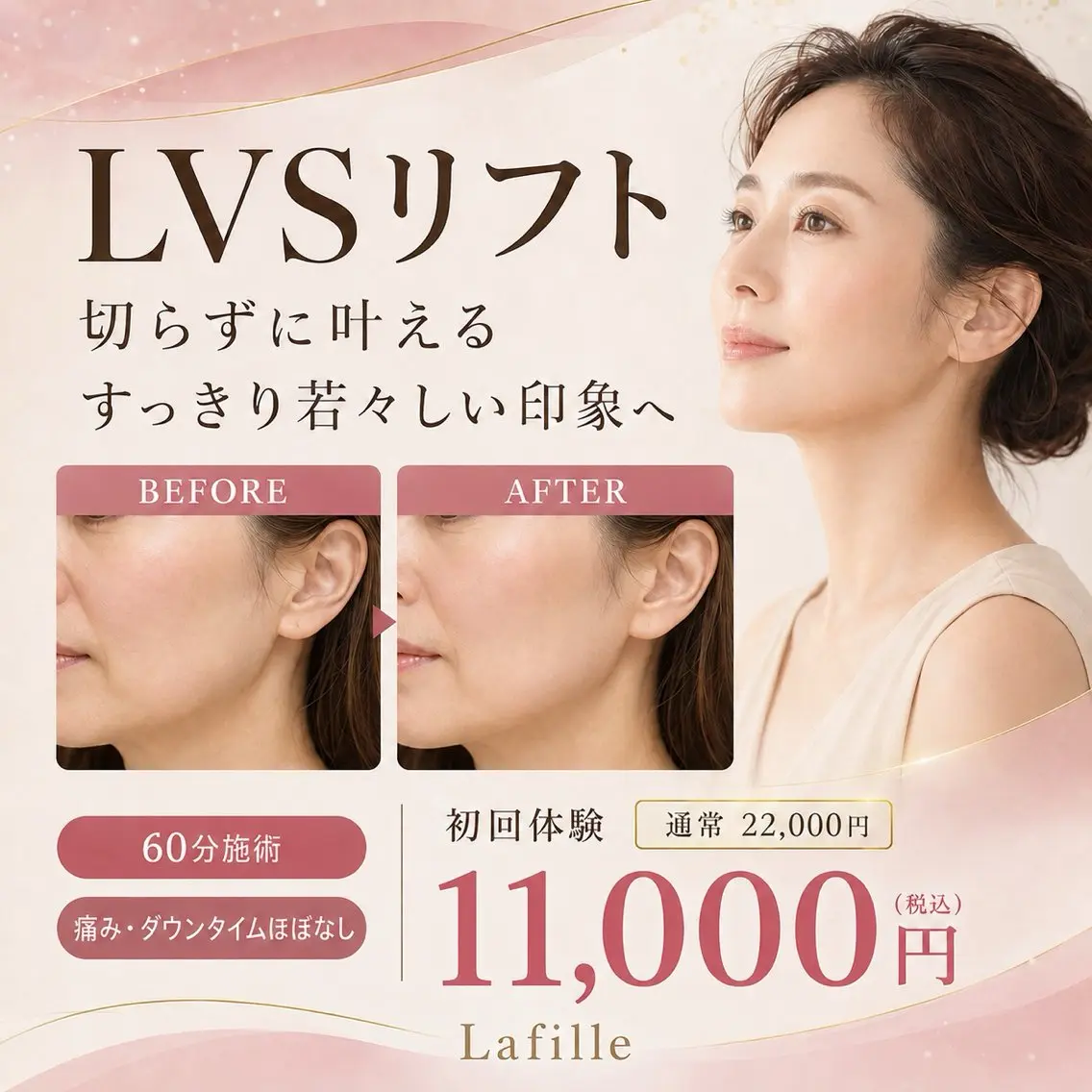 エステ ラフィーユ 豊崎店のエステ・リラクイメージ