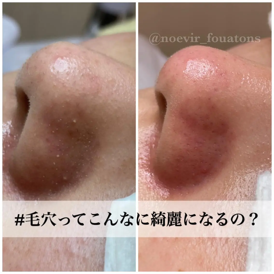 フェイシャルエステ ふわっとんのエステ・リラクイメージ