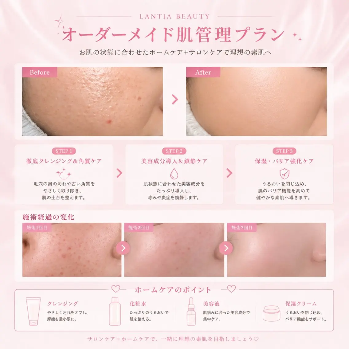 LANTIA YUNA肌管理 毛穴のエステ・リラクイメージ