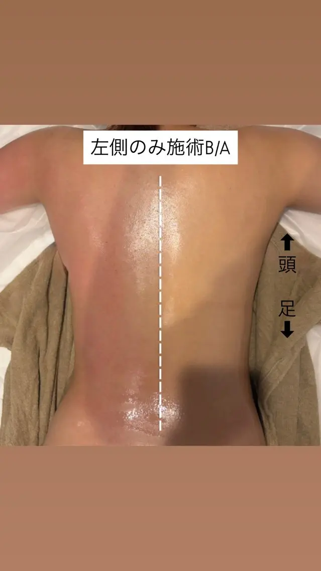 🫧【25歳以下限定】シークレットYボディケアの写真