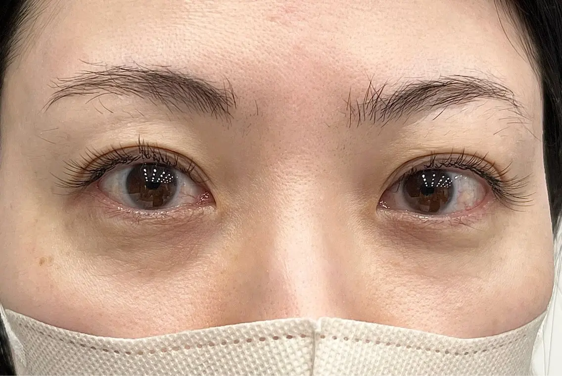 マツエク・マツパ 目尻長め eyeHbe TERAのマツエク・マツパデザイン