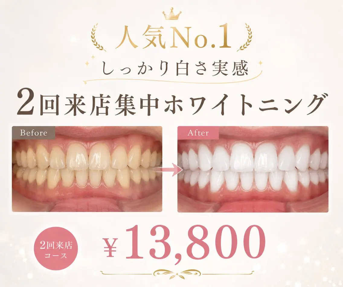 【ミニモ限定】【本気の白さ集中ケア】2回来店ホワイトニング🦷の写真