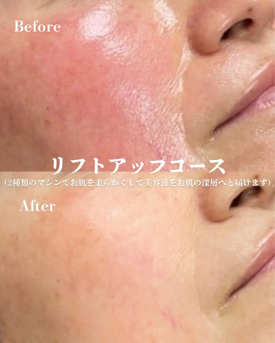 エステ D-Salon プライベートサロンのネイルデザイン