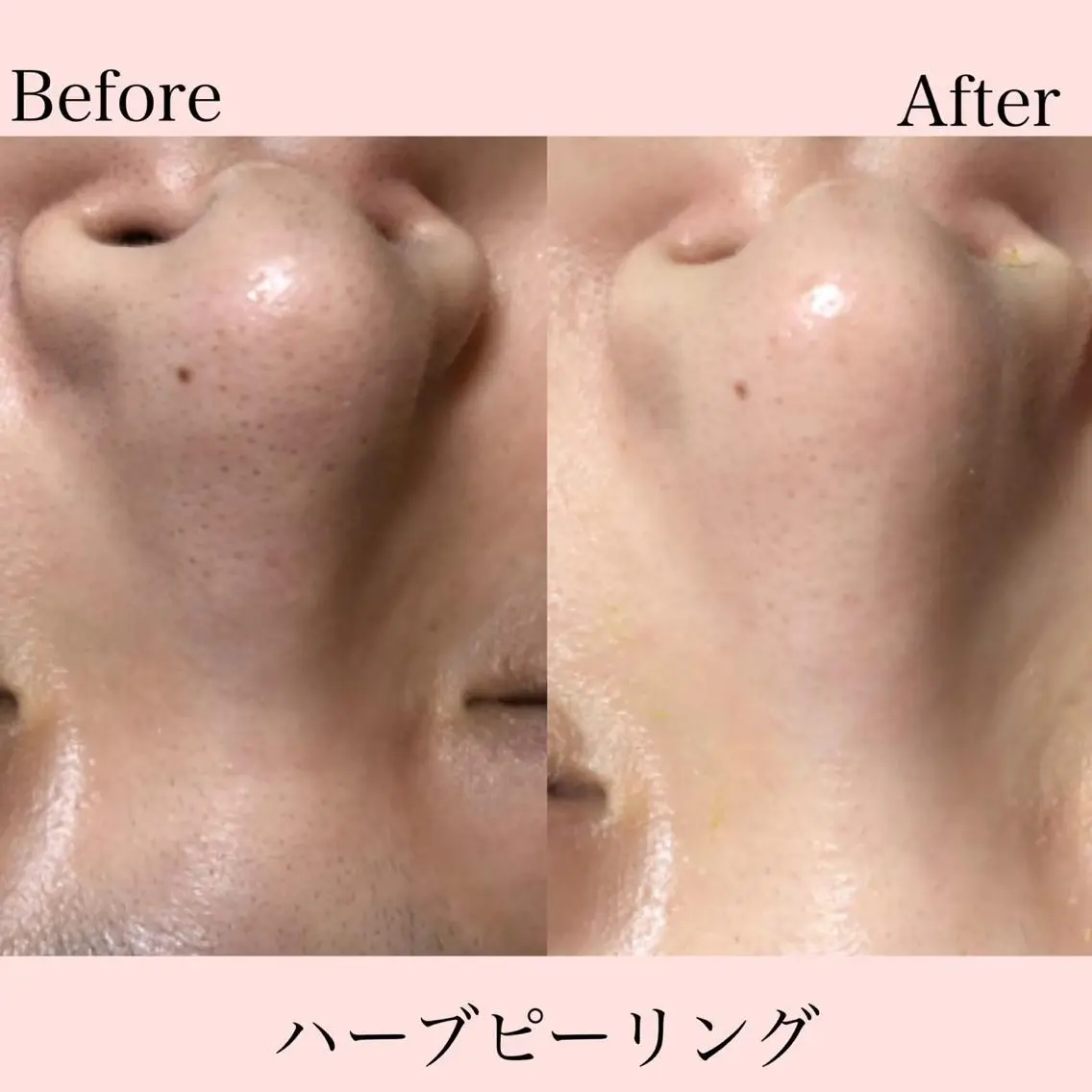 エステ パーソナルカラー診断 Petit六本木のマツエク・マツパデザイン