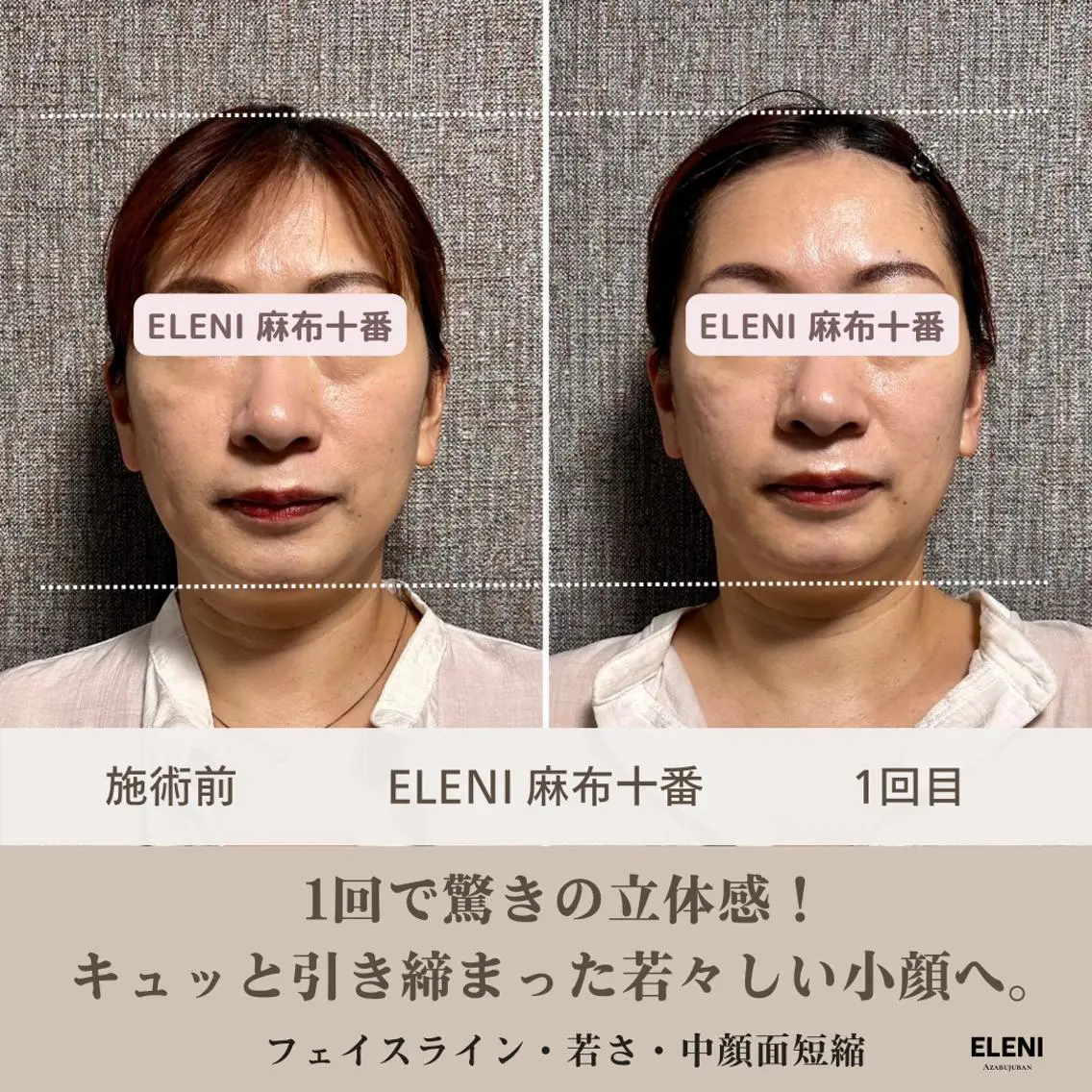 麻布十番小顔コルギ 姿勢矯正リアン💗のエステ・リラクイメージ