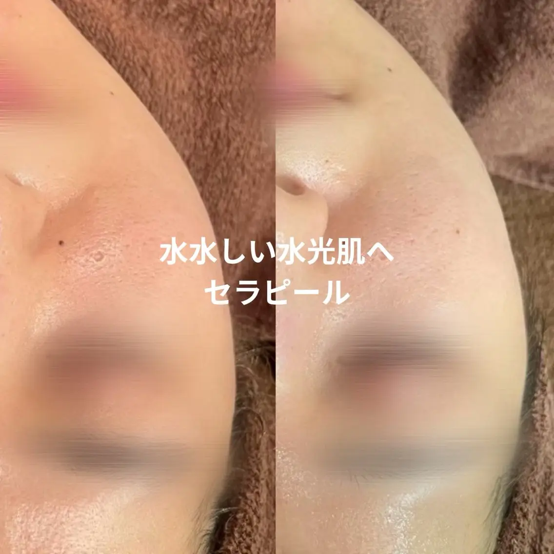 【LEPUS】レプス nishimoriのエステ・リラクイメージ
