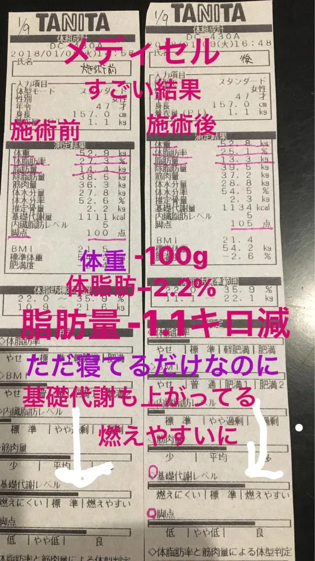 (新規様限定)身体引き締めメディセル&リンパケア&耳つぼセット!の写真