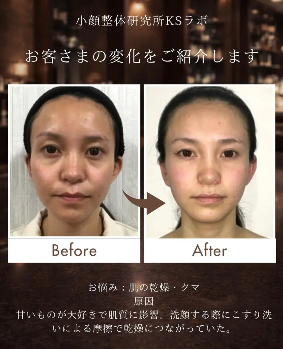 小顔整体研究所 KSラボ自由が丘店のエステ・リラクイメージ
