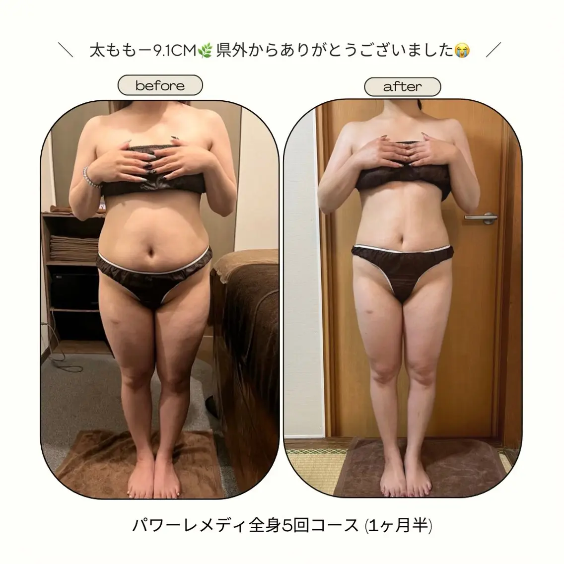 《本気痩せ×疲労改善 》  BILOOPのエステ・リラクイメージ