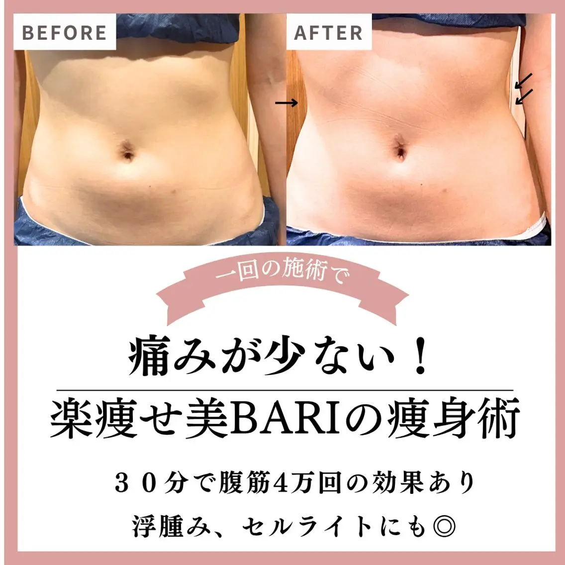 エステ 美BARI新宿店 Makiのエステ・リラクイメージ