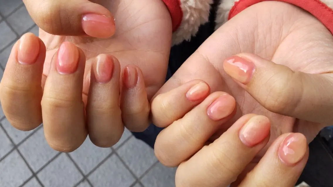 ネイル ぷっくりネイル MIURA＊ HIROKOのネイルデザイン