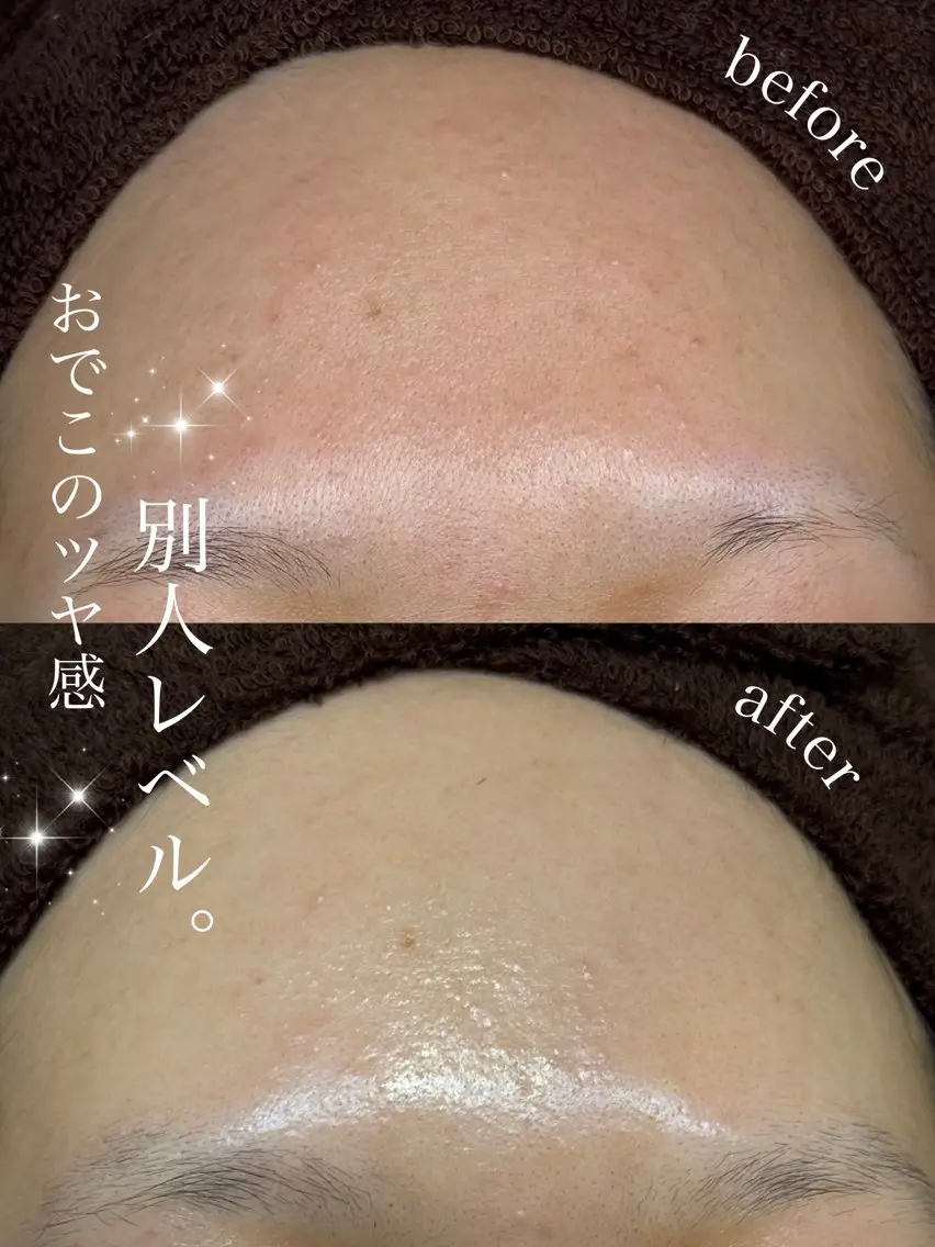 エステ 肌質改善×癒しサロン Ryanのエステ・リラクイメージ