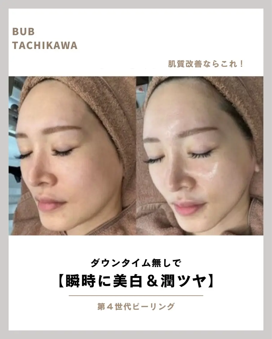 【くすみ・ニキビ・乾燥を全部解決】ララピール韓国肌管理｜透明感＋ハリ＋潤いを1回でチャージの写真