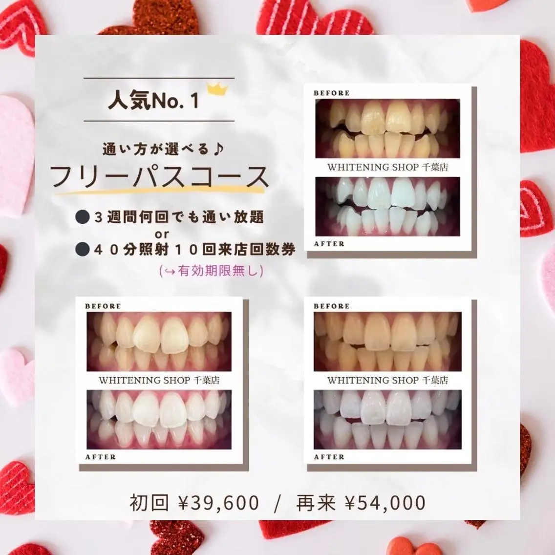 メンズ その他 ホワイトニング ショップ千葉店のその他イメージ