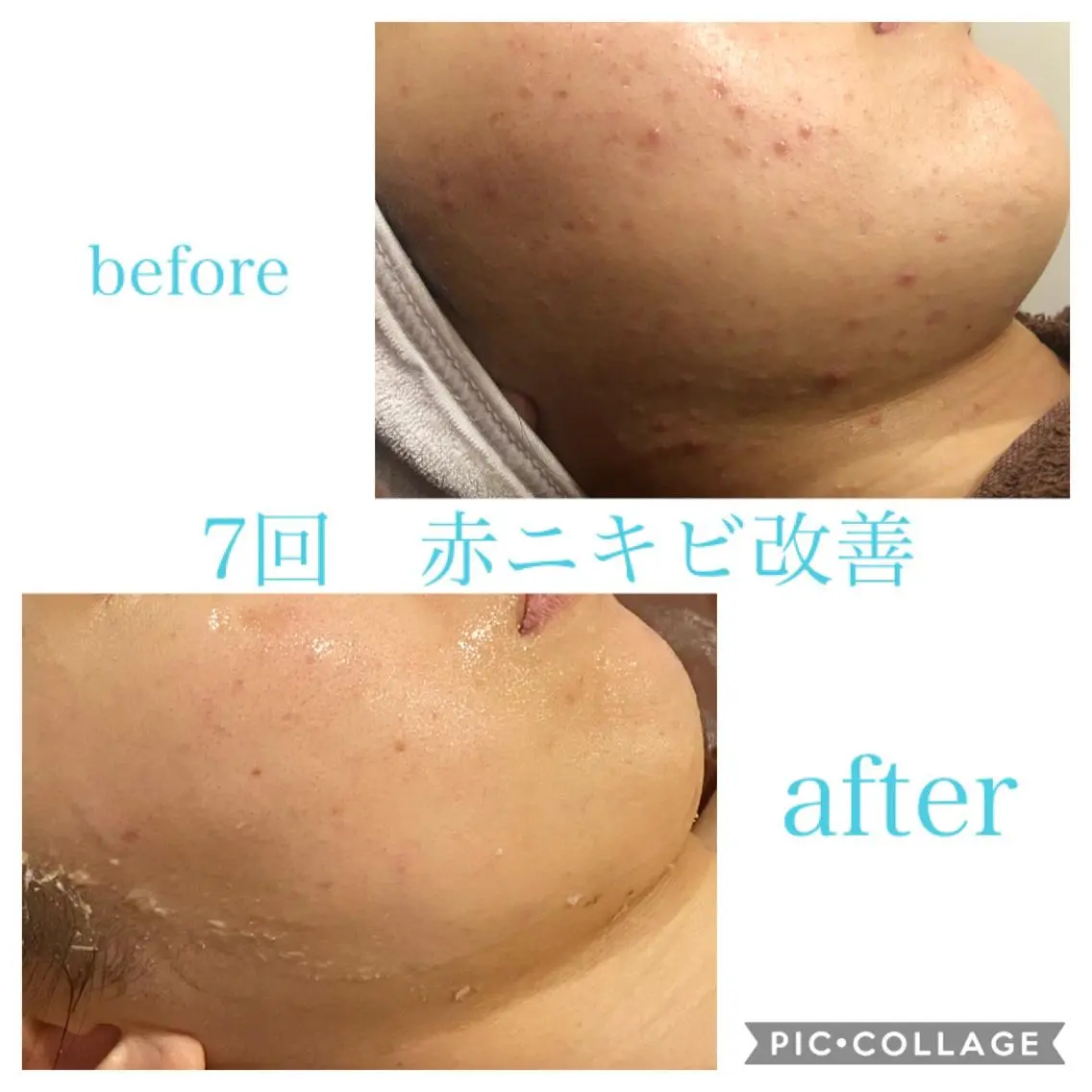 ロング カラー パーマ ヘアアレンジ メンズ ネイル マツエク・マツパ エステ リラク EnsorClair 代表 野口真央のエステ・リラクイメージ