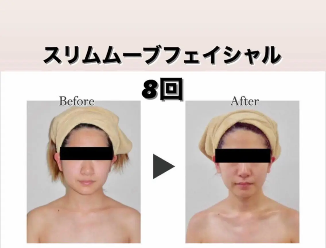 エステ エルモサ痩身脱毛 西八王子店のエステ・リラクイメージ