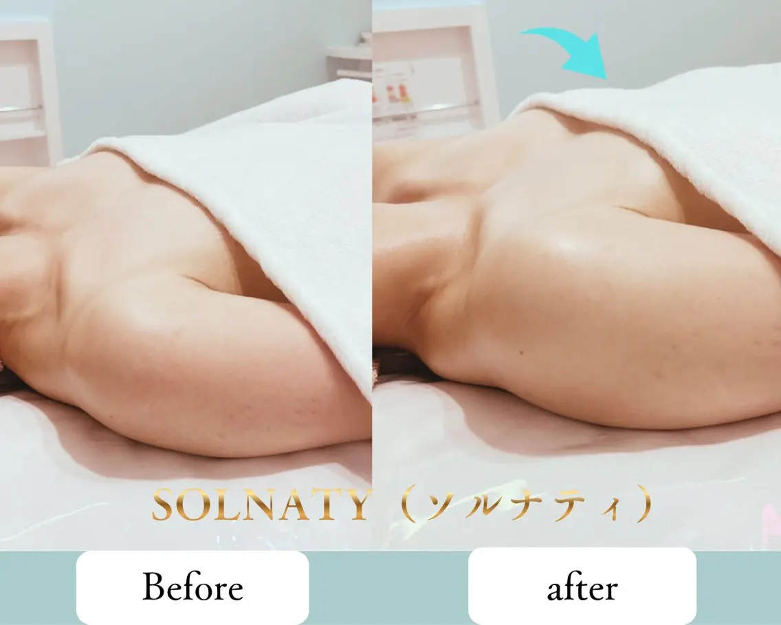 エステ SOLNATY YUのエステ・リラクイメージ
